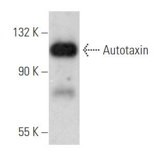 Autotaxin Antibody (E-12) | SCBT - Santa Cruz Biotechnology