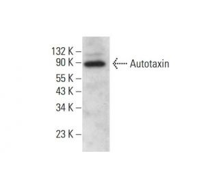 Autotaxin Antibody (E-12) - Western Blotting - Image 382058Each CRISPR/Cas9 Knockout (KO) Plasmid product consists of a pool of 3 plasmids designed to ensure identification and cleavage of a specific gene for maximum knockout efficiency. Each plasmid encodes a unique 20 nt sequence derived from the GeCKO (v2) library.