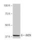 AVEN Antibody (3L3) - Western Blotting - Image 64863