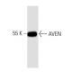 AVEN Antibody (48) - Western Blotting - Image 133299