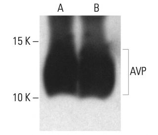 AVP Antibody (G-1) - Western Blotting - Image 402308