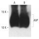 AVP Antibody (G-1) - Western Blotting - Image 402308