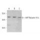 western blotting image from recommended AVP Receptor V1a (721CT25.2.1) monoclonal antibody replacement. Image 376892
