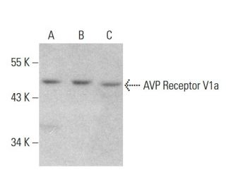 western blotting image from recommended AVP Receptor V1a (721CT25.2.1) monoclonal antibody replacement. Image 376892
