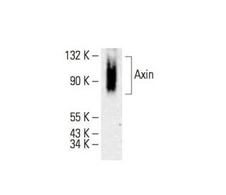 western blotting image from recommended Axin (G-3) monoclonal antibody replacement. Image 394774