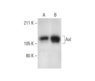 western blotting image from recommended Axl (H-3) monoclonal antibody replacement. Image 291025