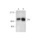western blotting image from recommended Axl (H-3) monoclonal antibody replacement. Image 291025
