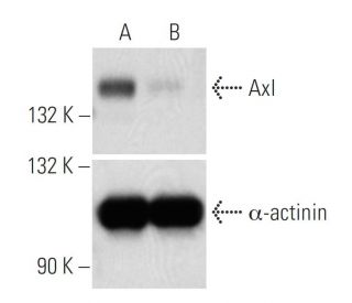 Axl siRNA (h): sc-29769. Western blot analysis of Axl expression in non-transfected control (A) and Axl siRNA transfected 