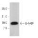 B-FABP Antibody (F-6) - Western Blotting - Image 379373