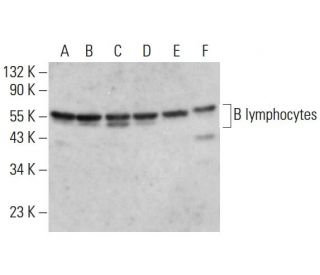 B lymphocytes Antibody (Lym-1) - Western Blotting - Image 377264 