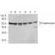 B lymphocytes Antibody (Lym-1) - Western Blotting - Image 377264 