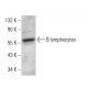 B lymphocytes Antibody (Lym-1) - Western Blotting - Image 377266