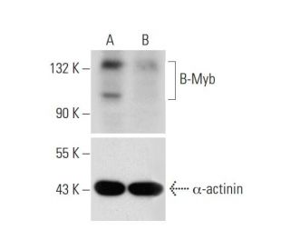 B-Myb Double Nickase Plasmid (h): sc-401318-NIC. Western blot analysis of B-Myb expression in non-transfected control (A)The Double Nickase Plasmid features a U6 promoter for sgRNA expression, a 20 nt targeting sequence, and a gRNA scaffold to guide Cas9n. It includes a CBh promoter for Cas9n (D10A) and puromycin resistance, GFP for transfection verification, and nuclear localization signals (NLS). The 2A peptide allows co-expression of Cas9n and Puro from a single promoter, enabling precise genome editing with reduced off-target effects. 