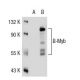 B-Myb (MYBAD10A): sc-81192. Western blot analysis of B-Myb expression in non-transfected: sc-117752 (A) and human B-Myb tr