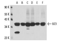 B23/Nucleophosmin Antibody (3F291) | SCBT - Santa Cruz Biotechnology