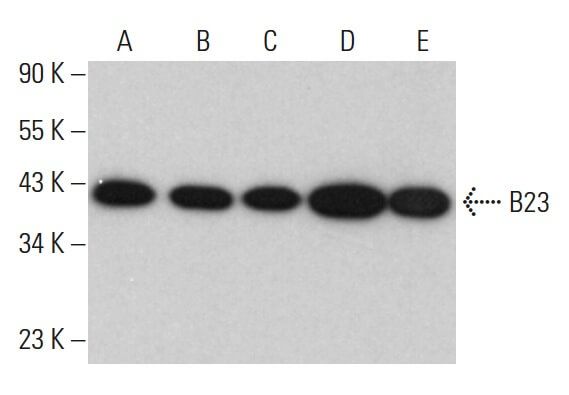 B23/Nucleophosmin抗体 (E-3) | SCBT - Santa Cruz Biotechnology