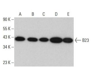western blotting image from recommended B23/Nucleophosmin (E-3) monoclonal antibody replacement. Image 377251
