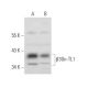 β3Gn-TL1 Antibody (A-9) - Western Blotting - Image 318429 