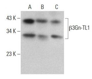 &beta;3Gn-TL1 Antibody (A-9) - Western Blotting - Image 376060 