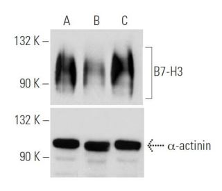 B7-H3 shRNA Plasmid (h): sc-45444-SH. Western blot analysis of human B7-H3 expression in non-transfected (A), B7-H3 shRNA 