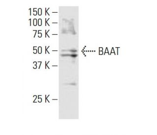 BAAT Antibody (ZA-18) - Western Blotting - Image 33847