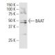 BAAT Antibody (ZA-18) - Western Blotting - Image 33847