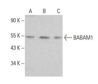 BABAM1 Antibody (H-10) - Western Blotting - Image 379018Each CRISPR/Cas9 Knockout (KO) Plasmid product consists of a pool of 3 plasmids designed to ensure identification and cleavage of a specific gene for maximum knockout efficiency. Each plasmid encodes a unique 20 nt sequence derived from the GeCKO (v2) library.