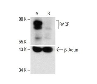 BACE Antibody (A-12) - Western Blotting - Image 332326 