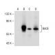 This polyclonal antibody has been discontinued. See our recommended <a href="bace-antibody-61-3e7">BACE (61-3E7)</a> monoclonal antibody (sample data shown). western blotting image from recommended BACE (61-3E7) monoclonal antibody replacement. Image 141596