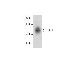BACE Antibody (H-10) - Western Blotting - Image 286064The Double Nickase Plasmid features a U6 promoter for sgRNA expression, a 20 nt targeting sequence, and a gRNA scaffold to guide Cas9n. It includes a CBh promoter for Cas9n (D10A) and puromycin resistance, GFP for transfection verification, and nuclear localization signals (NLS). The 2A peptide allows co-expression of Cas9n and Puro from a single promoter, enabling precise genome editing with reduced off-target effects.