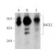 BACE2 Antibody (F-12) - Western Blotting - Image 359926 