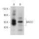 BACE2 Antibody (F-12) - Western Blotting - Image 374947