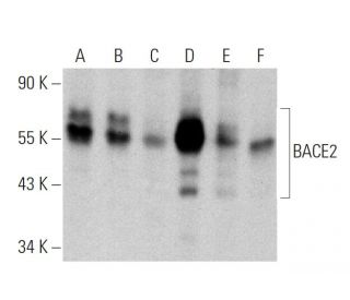BACE2 Antibody (H-3) - Western Blotting - Image 359925Each CRISPR/Cas9 Knockout (KO) Plasmid product consists of a pool of 3 plasmids designed to ensure identification and cleavage of a specific gene for maximum knockout efficiency. Each plasmid encodes a unique 20 nt sequence derived from the GeCKO (v2) library.