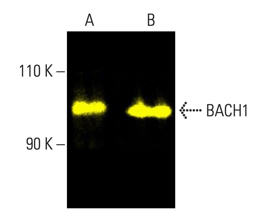 びれい！！！！ BACH1抗体(F-9) | SCBT - Santa Cruz Biotechnology
