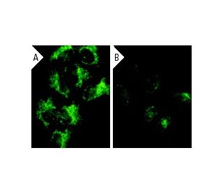 Bad siRNA (h): sc-29778. Immunofluorescence staining of methanol-fixed, control HeLa... 