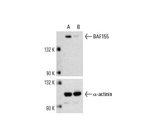 BAF155 siRNA (h): sc-29780. Western blot analysis of BAF155 expression in non-transfected control (A) and BAF155 siRNA tra 