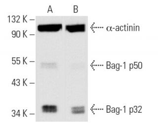 Bag-1 siRNA (h): sc-29211. Western blot analysis of Bag-1 expression in non-transfected control (A) and Bag-1 siRNA transf 