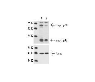 Bag-1 siRNA (m): sc-29784. Western blot analysis of Bag-1 expression in non-transfected control (A) and Bag-1 siRNA transf 