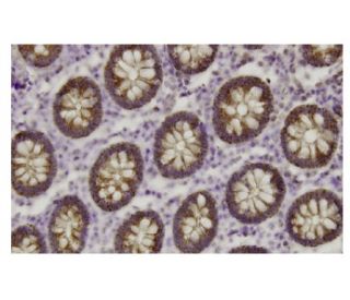 BAIAP2L1 Antibody (A-14) - Immunohistochemistry - Image 36118 