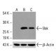 Bak 항체 (AT38E2): sc-517390. 미처리 (A) 및 화학 처리 (B, C)된 HeLa 전체 세포 용해물에서 Bak 발현에 대한 웨스턴 블롯 분석. 사용된 검출 시약: m-IgGκ BP-HRP: sc-516102. β-액틴 (C4): sc-47778을 로딩 대조군으로 사용. 사용된 검출 시약: m-IgG Fc BP-HRP: sc-525409. Bak Antibody (AT38E2) - Western Blotting - Image 416474