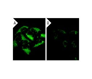 Bak siRNA (h): sc-29786. Immunofluorescence staining of methanol-fixed, control HeLa (A) and Bak siRNA silenced HeLa (B) c 