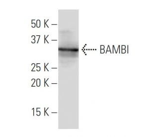 BAMBI Antibody (3B7) - Western Blotting - Image 34053SAM Transcription Activation: SAM system utilizing dCas9-VP64, MS2-P65-HSF1, and sgRNA for precise gene transcription activation.