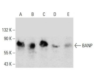 BANP Antibody (1524CT337.6.32) - Western Blotting - Image 384538Each CRISPR/Cas9 Knockout (KO) Plasmid product consists of a pool of 3 plasmids designed to ensure identification and cleavage of a specific gene for maximum knockout efficiency. Each plasmid encodes a unique 20 nt sequence derived from the GeCKO (v2) library.