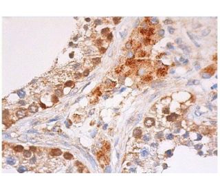 BAP1 Antibody C 4 SCBT Santa Cruz Biotechnology