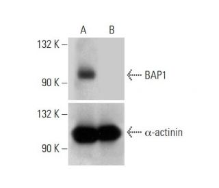 BAP1 Double Nickase Plasmid (h): sc-400232-NIC. Western blot analysis of BAP1 expression in non-transfected control (A) anThe Double Nickase Plasmid features a U6 promoter for sgRNA expression, a 20 nt targeting sequence, and a gRNA scaffold to guide Cas9n. It includes a CBh promoter for Cas9n (D10A) and puromycin resistance, GFP for transfection verification, and nuclear localization signals (NLS). The 2A peptide allows co-expression of Cas9n and Puro from a single promoter, enabling precise genome editing with reduced off-target effects.