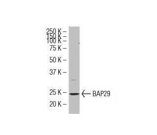 BAP29 Antibody (W352) - Western Blotting - Image 34574 
