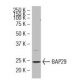 BAP29 Antibody (W352) - Western Blotting - Image 34574 