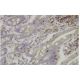 BAR Antibody (L-16) - Immunohistochemistry - Image 36344