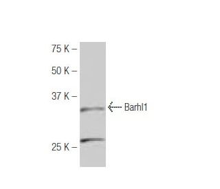 Barhl1 Antibody (KA.25) - Western Blotting - Image 53965