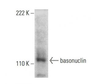 basonuclin Antibody (1F4) - Western Blotting - Image 384453The Double Nickase Plasmid features a U6 promoter for sgRNA expression, a 20 nt targeting sequence, and a gRNA scaffold to guide Cas9n. It includes a CBh promoter for Cas9n (D10A) and puromycin resistance, GFP for transfection verification, and nuclear localization signals (NLS). The 2A peptide allows co-expression of Cas9n and Puro from a single promoter, enabling precise genome editing with reduced off-target effects.